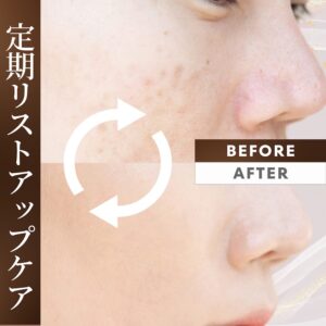 リフトアップやたるみが気になる方へのフェイスケア