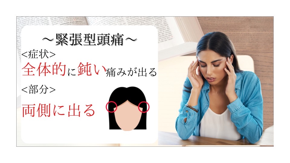 緊張型頭痛の特徴を示すイメージ