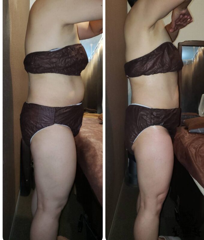 ダイエットに取り組んだ方の身体の変化